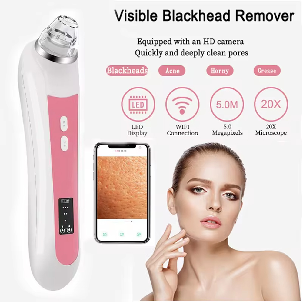 Nasal Aspirator - Aspirapolvere per la rimozione dei punti