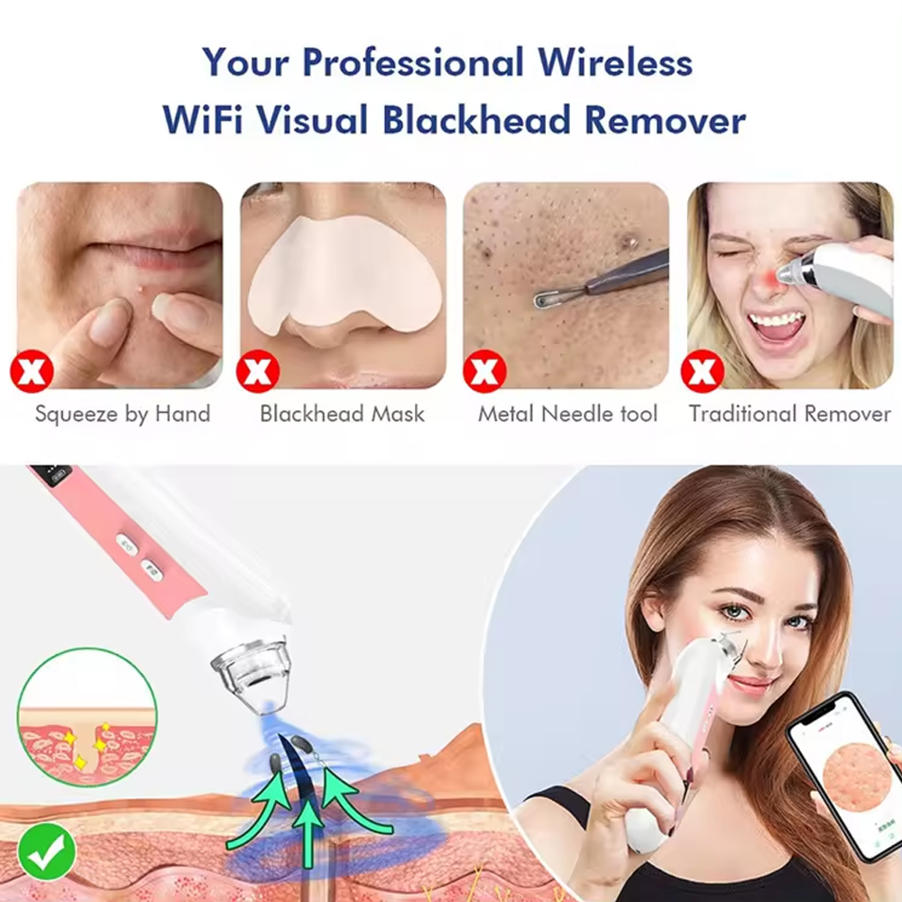 Aspirapolvere per la rimozione - Nasal Aspirator recensione e prezzo