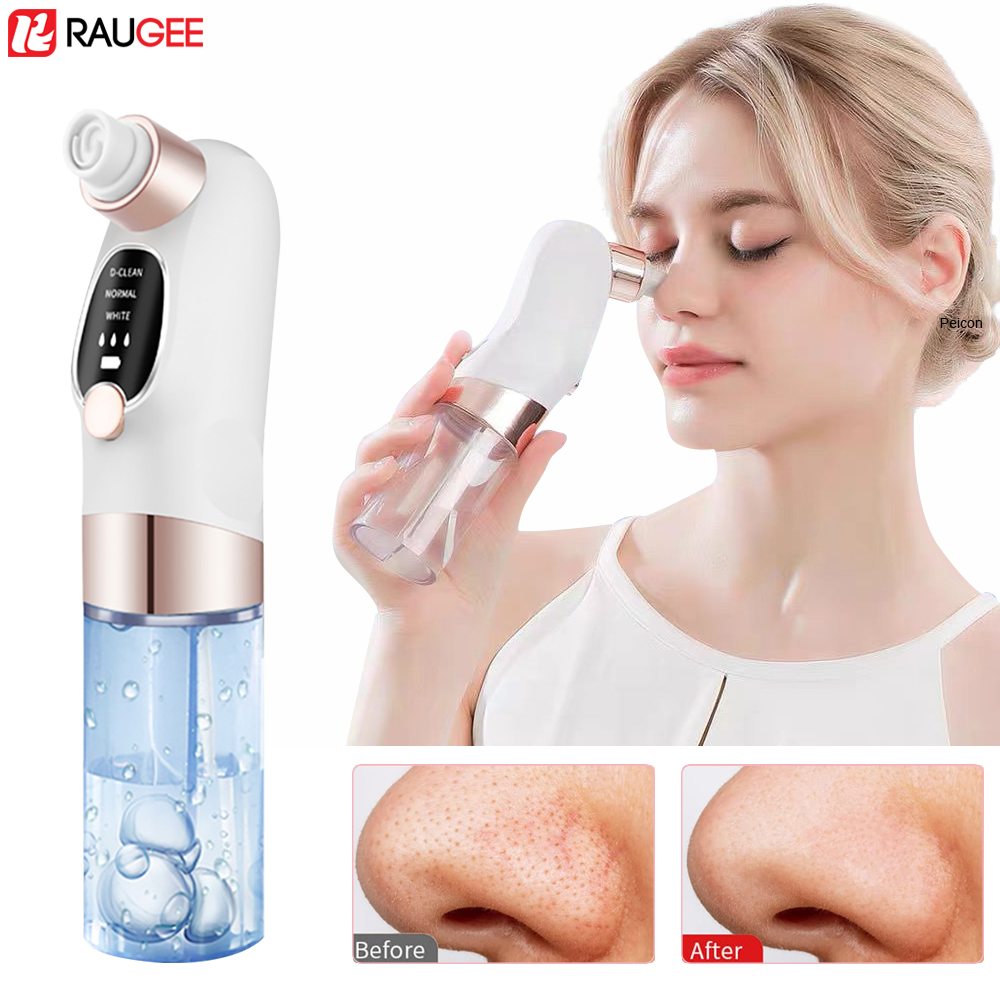Estrattore di punti neri Estra - Nasal Aspirator recensione e prezzo